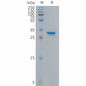 Human CCL19 Protein, hFc Tag