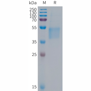 Human FSHB Protein, hFc Tag
