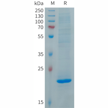 Human C6 Protein, His Tag