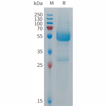 Human EPHB3 Protein, His Tag