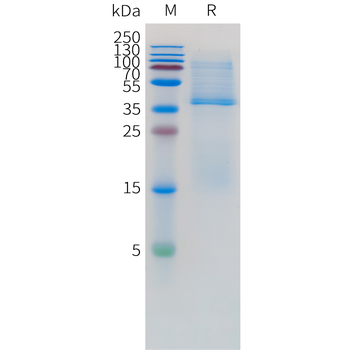 Human CCL24 Protein, hFc Tag