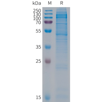 Human ROR1(838-937) Protein, hFc Tag
