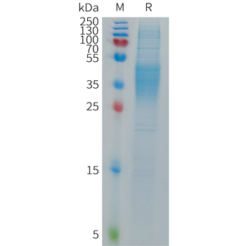 Human HER3(1243-1342) Protein, hFc Tag
