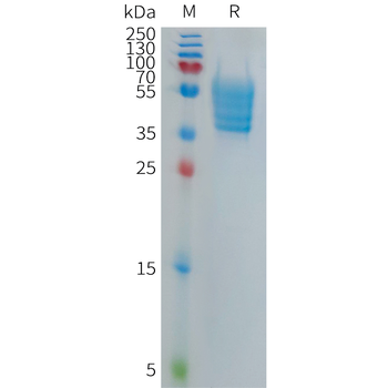Human TIM3 Protein, hFc Tag