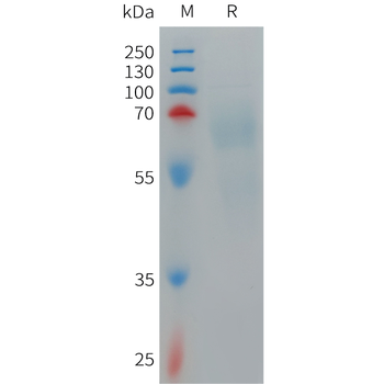 Human CXCR6 Protein, hFc Tag
