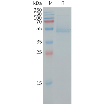Human CGRPR and RAMP1 Heterodimer Protein, hFc Tag and mFc Tag