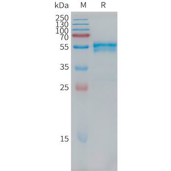Human LINGO1 Protein, His Tag