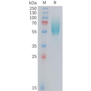Human ACVR2B Protein, mFc Tag