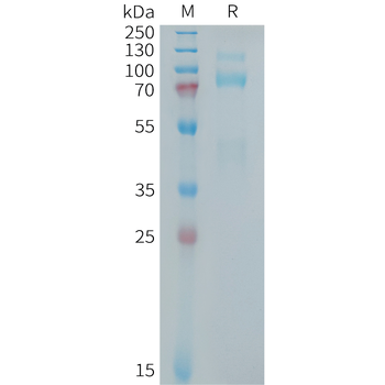Human CDH1(594-709) Protein, hFc Tag