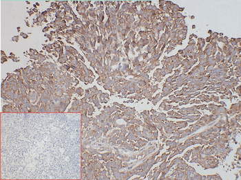 ADAM9 Antibody