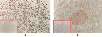 FCRL5 Antibody