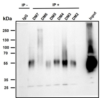 Anti-BCMA antibody(DM6); Rabbit mAb