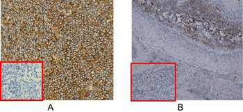 Anti-CD38 antibody(DM28); Rabbit mAb