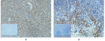 Anti-CD38 antibody(DM28); Rabbit mAb