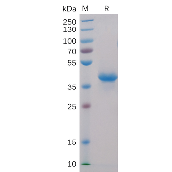 Human BCMA Protein, hFc-His Tag