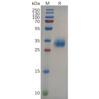 Human 2B4 Protein, mFc-His Tag