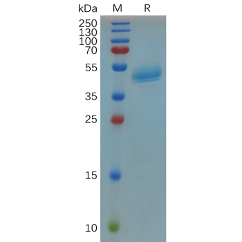 Human CD28 Protein, mFc-His Tag