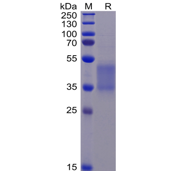 Human EPCAM Protein, His Tag