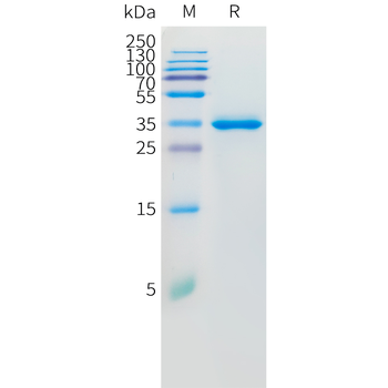 Human CD30 Protein, His tag