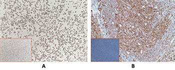 Anti-mesothelin antibody(DM71), Rabbit mAb