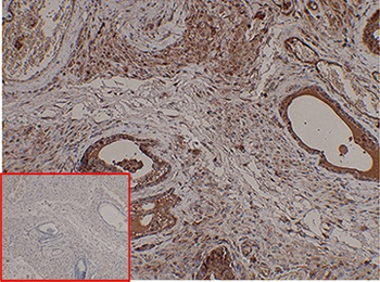 Anti-PSCA antibody(DM87), Rabbit mAb