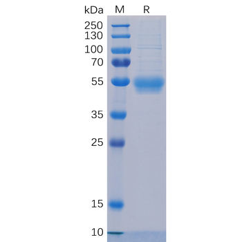 Human MUC1 Protein, HisTag