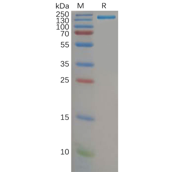 Human ROR1 Protein, His Tag