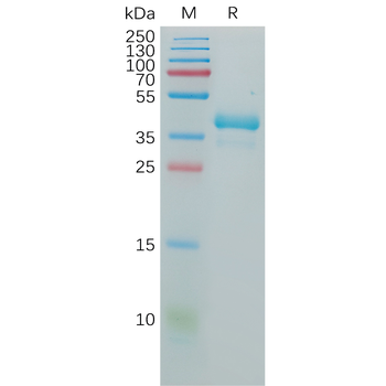 Human LAG3 Protein, hFc Tag
