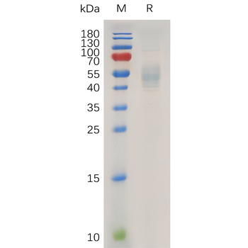 Human Galectin 9 Protein, hFc Tag