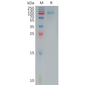 Human MASP2 Protein, hFc Tag