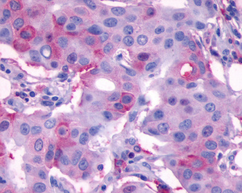MC4R/Melanocortin 4 Receptor Antibody