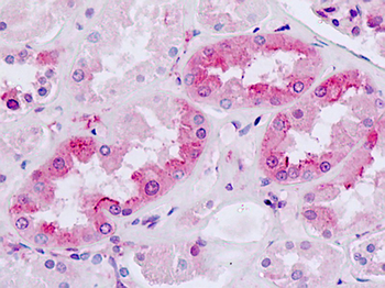 MC4R/Melanocortin 4 Receptor Antibody