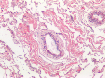 PIK3CA/PI3K Alpha Antibody