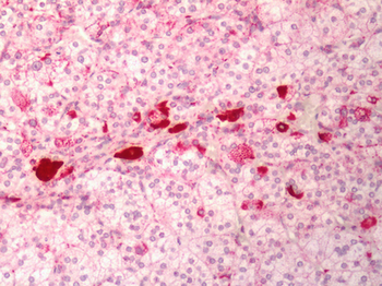 MC1R Antibody