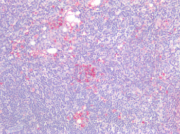 PD-L2/PDCD1LG2/CD273 Antibody