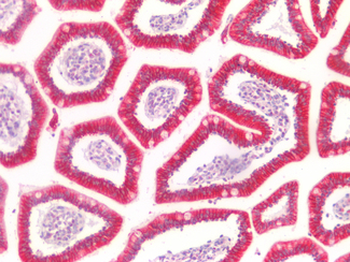 KRT20/CK20/Cytokeratin 20 Antibody