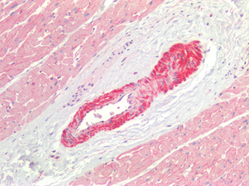 PTGS2/COX2/COX-2 Antibody