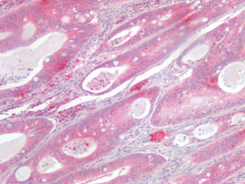 KRAS Antibody