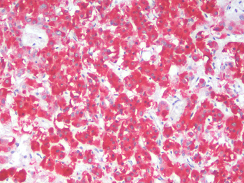 PIK3CA/PI3K Alpha Antibody