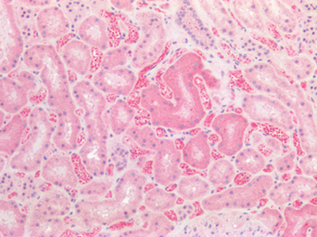 SLC2A2/GLUT2 Antibody