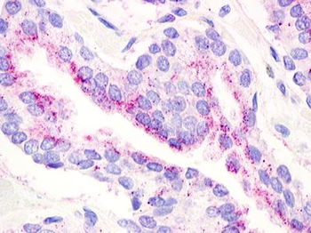 GPR21 Antibody