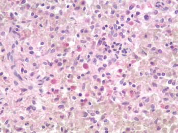 LAG3 Antibody