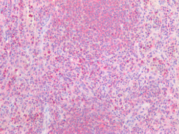 PD-L2/PDCD1LG2/CD273 Antibody