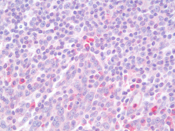 CD274/B7-H1/PD-L1 Antibody