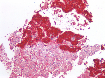 CD276/B7-H3 Antibody
