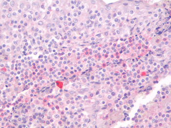 CD3E Antibody