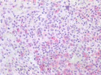 CD19 Antibody