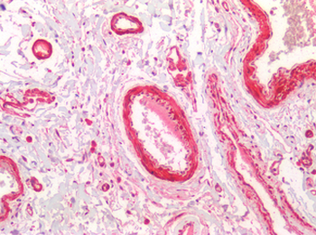 HTR1B/5-HT1B Receptor Antibody