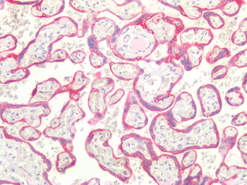 CD36 Antibody