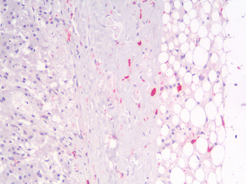 CD163 Antibody